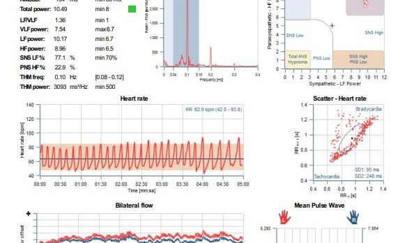 .Analisi, monitoraggio e biofeedback del sistema nervoso autonomo e della variabilità della frequenza cardiaca | Elisa Srls
